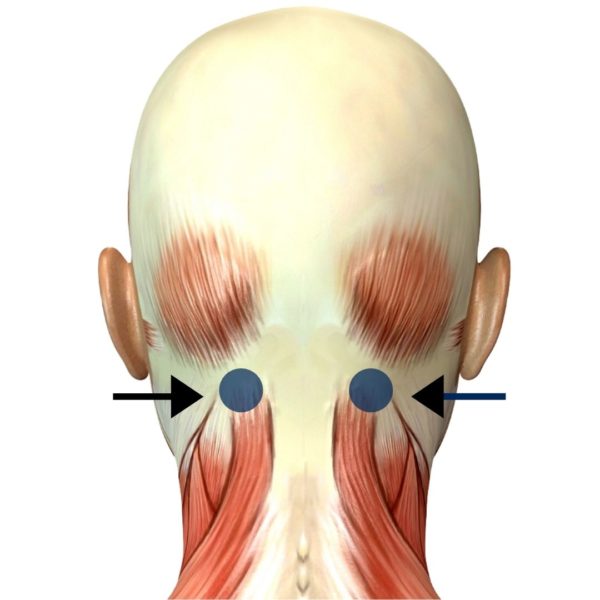 Common Tension Headache Trigger Points - Palestra Boutique Spa